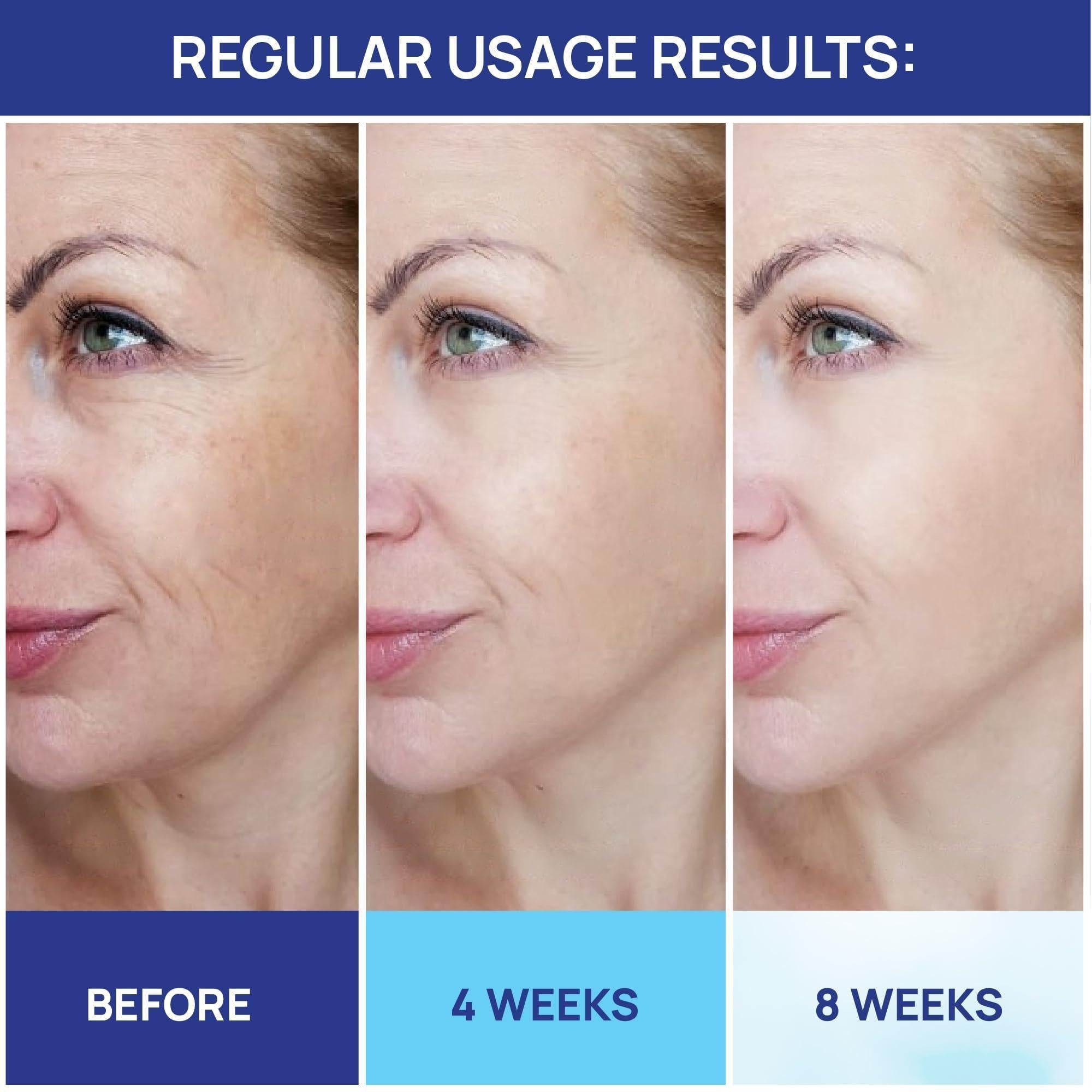 Crème au Rétinol pour le Visage: Hydratant au Collagène et Rétinol avec Acide Hyaluronique